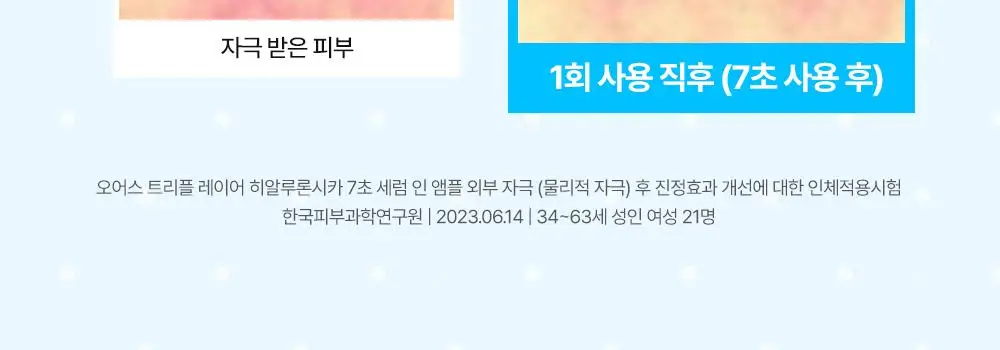 [부루부루도그 콜라보] 오어스 히알루론시카 7초 세럼 인 앰플 105ml 기획 (+애착베개키링,치크팩2p) 상세페이지 18